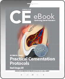 Practical Cementation Protocols eBook Thumbnail