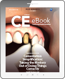 Cementation Simplification: Taking the Mystery Out of Doing Things Correctly eBook Thumbnail