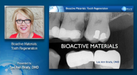 Bioactive Materials: Tooth Regeneration Webinar Thumbnail