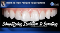 Isolation and Bonding Protocols for Indirect Restorations Webinar Thumbnail