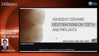 Adhesive Ceramic Restorations on Teeth and Implants Webinar Thumbnail