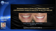 Designing Smiles Can Be Fun and Predictable Webinar Thumbnail