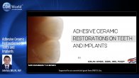 Adhesive Ceramic Restorations on Teeth and Implants Webinar Thumbnail