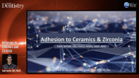 Adhesion to Ceramics and Zirconia Webinar Thumbnail