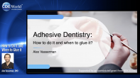 How to Do it and When to Glue it Webinar Thumbnail