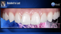 Bonded to Last Webinar Thumbnail